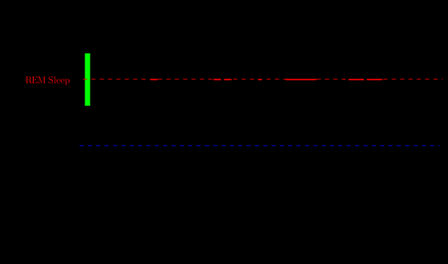 800px-Sleep_Hypnogram.svg (1).png